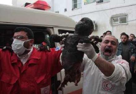 Halálra égett kisgyermek, az izraeli foszforbombaeső után. Gáza City. 2009. január 8. – Fotó Fady Awan